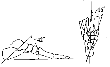oblique axis of left subtalar joint