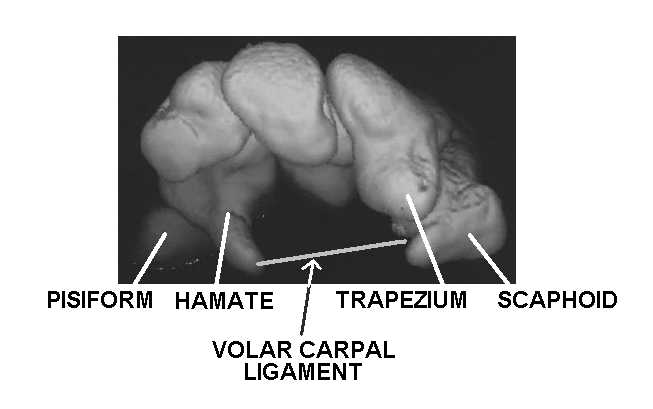 3D view of bones of carpal tunnel