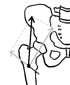 trochanteric fracture