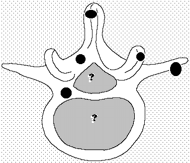 transverse plane view of vertebra