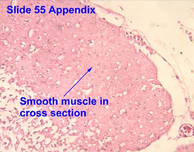 skeletal muscle cross section labeled