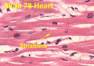 cardiac muscle striations