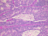 Com304-1-LM1.gif (300026 bytes)