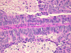 Com304-1-LM2.gif (282835 bytes)