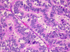 Com304-1-MM1.gif (293855 bytes)