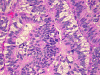 Com304-1-MM2.gif (291780 bytes)