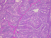 Com304-1-SM1.gif (320816 bytes)