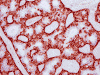 Com304-3-SmoothMuscleActin.gif (89529 bytes)