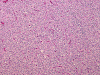 Com307-1-DD-Oligo2.gif (165921 bytes)