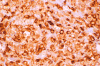 Com401-1-Myeloperoxidase.gif (157753 bytes)