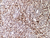 Com406-1-8-reticulin.gif (199310 bytes)
